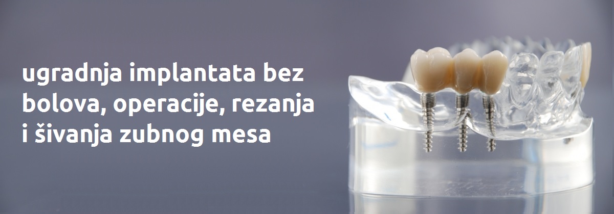 implantat